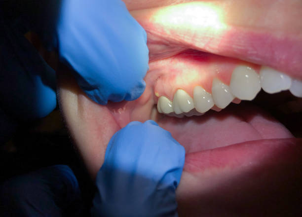Best After-Hours Emergency Dentist in Crystal, MN